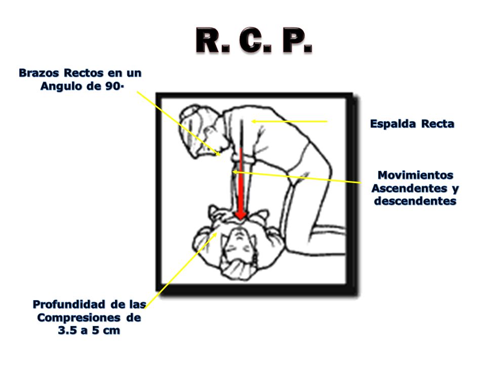 R. C. P. Espalda Recta Brazos Rectos en un Angulo de 90· Movimientos