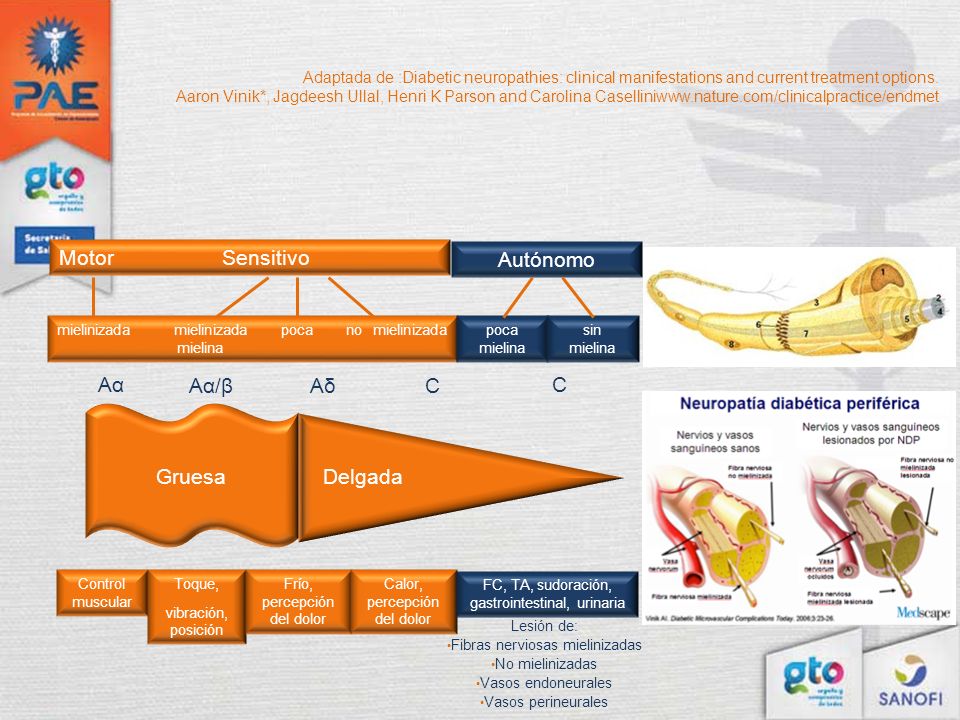Motor Sensitivo Autónomo Aα Aα/β Aδ C C Gruesa Delgada