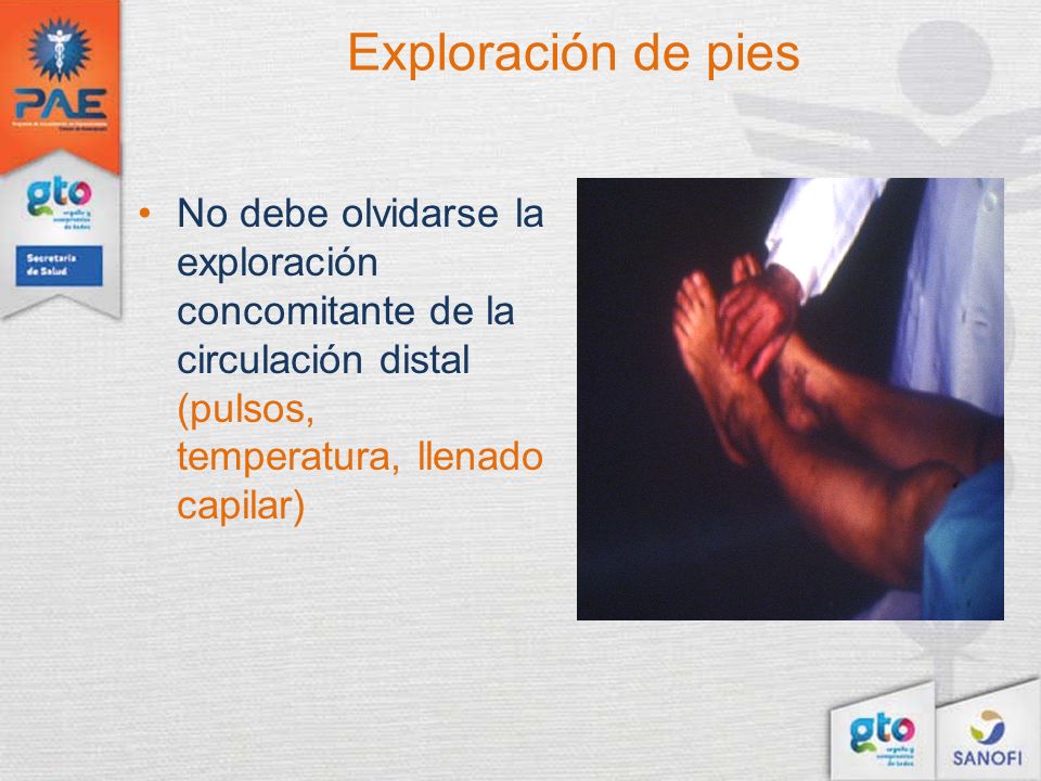 Exploración de pies No debe olvidarse la exploración concomitante de la circulación distal (pulsos, temperatura, llenado capilar)