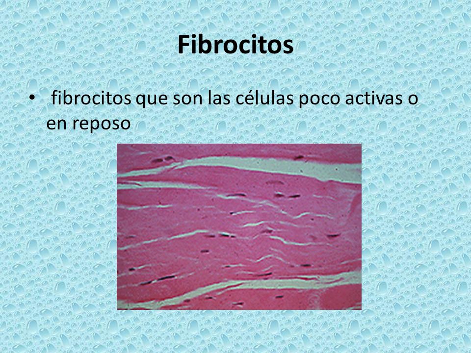 Fibrocitos fibrocitos que son las células poco activas o en reposo
