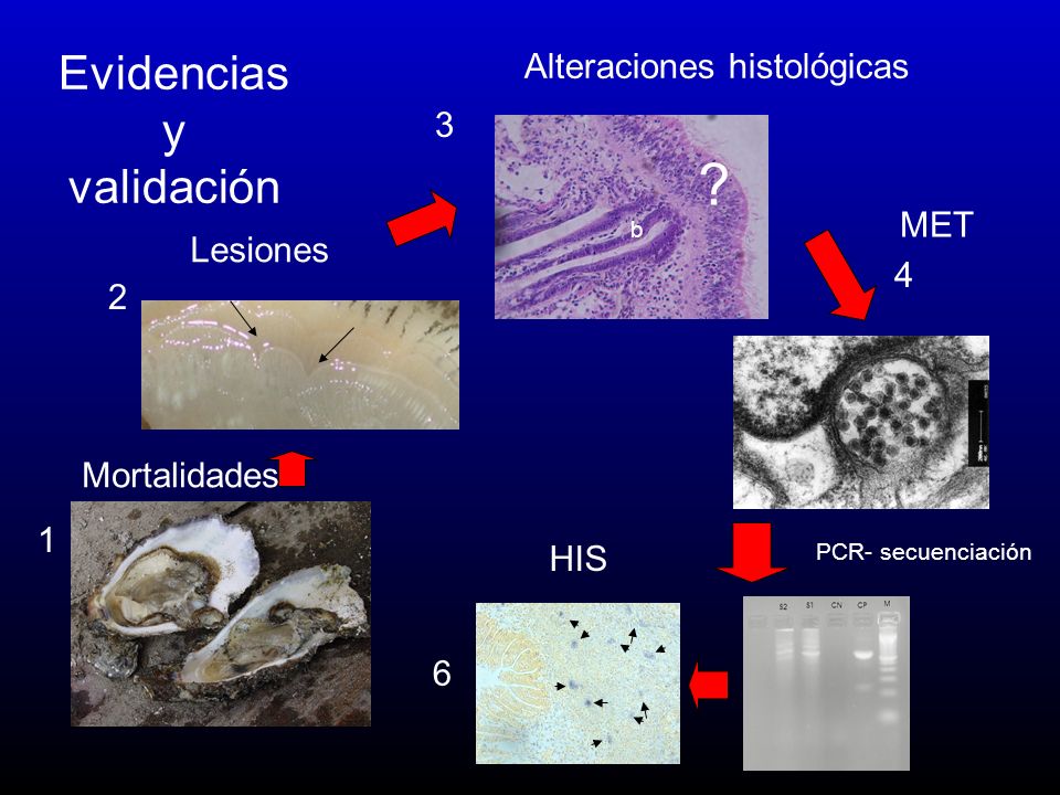 Evidencias y validación Alteraciones histológicas 3 MET Lesiones 4 2
