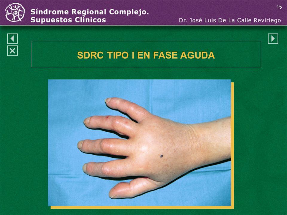 SDRC TIPO I EN FASE AGUDA