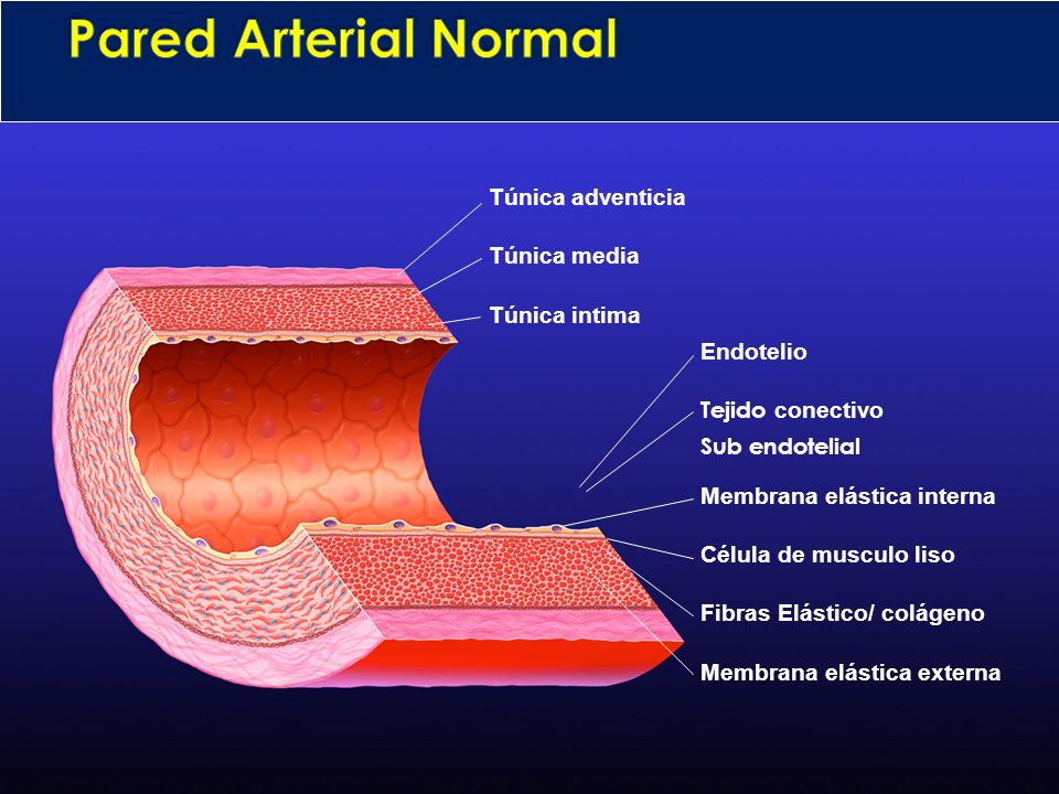 Pared Arterial Normal Túnica adventicia Túnica media Túnica intima