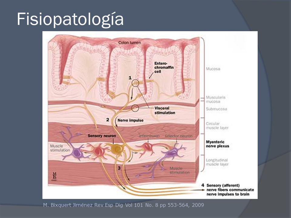 Fisiopatología M. Bixquert Jiménez Rev Esp Dig Vol 101 No. 8 pp , 2009