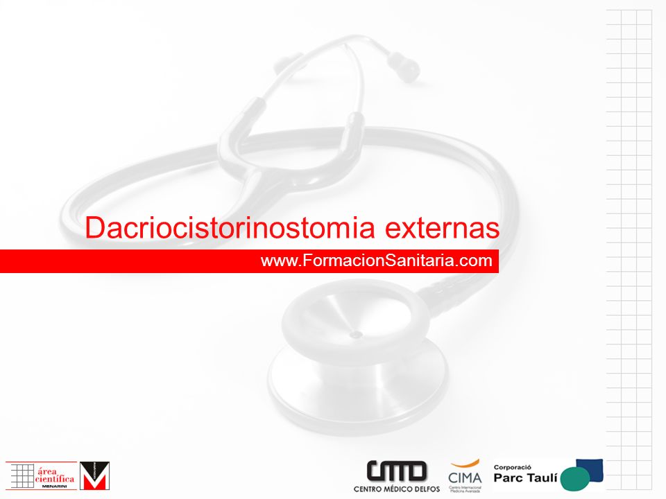 Dacriocistorinostomia externas