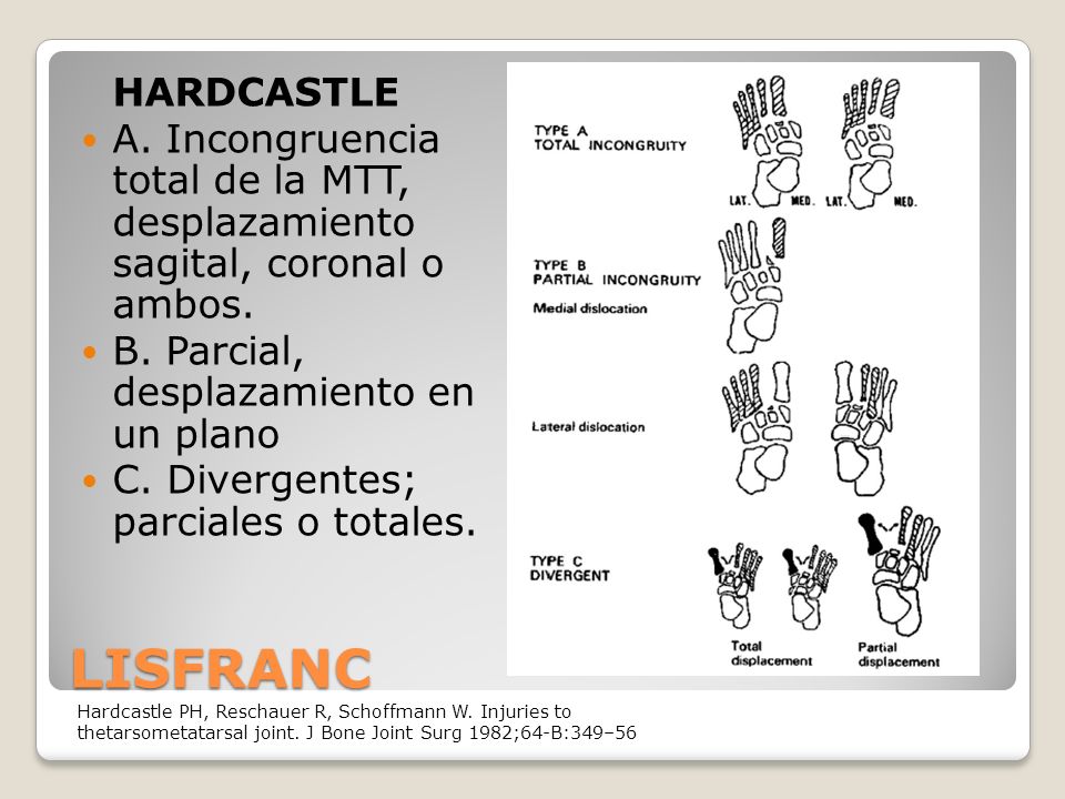 HARDCASTLE A. Incongruencia total de la MTT, desplazamiento sagital, coronal o ambos. B. Parcial, desplazamiento en un plano.
