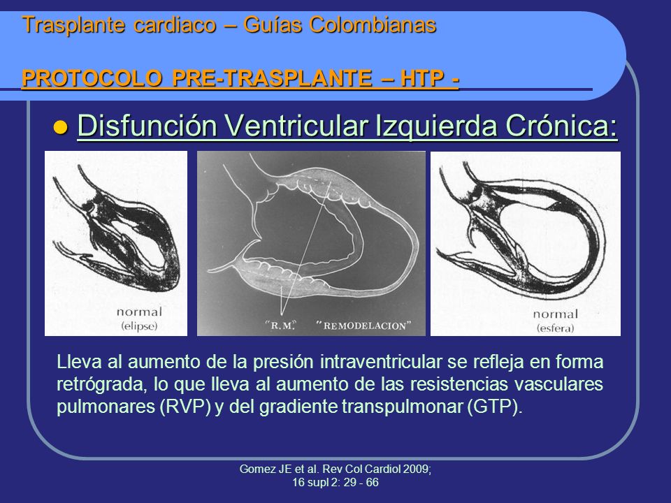 Gomez JE et al. Rev Col Cardiol 2009; 16 supl 2: