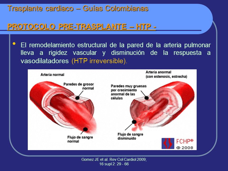 Gomez JE et al. Rev Col Cardiol 2009; 16 supl 2: