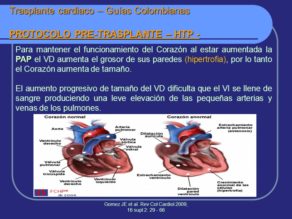 Gomez JE et al. Rev Col Cardiol 2009; 16 supl 2: