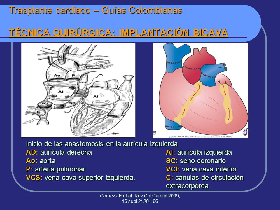 Gomez JE et al. Rev Col Cardiol 2009; 16 supl 2: