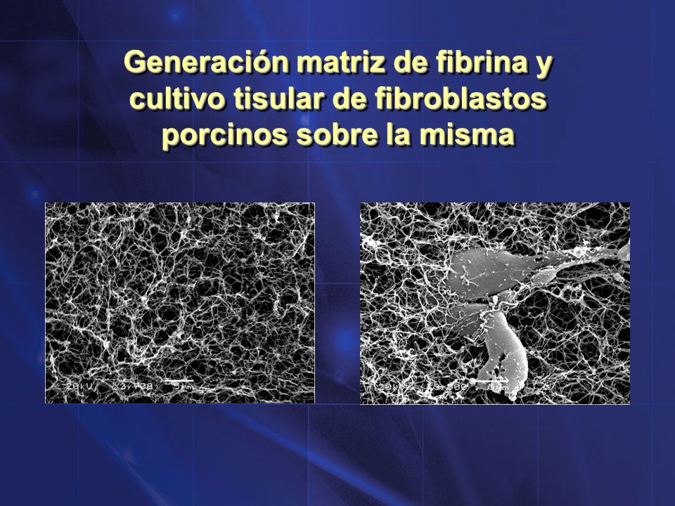 Generación matriz de fibrina y cultivo tisular de fibroblastos porcinos sobre la misma