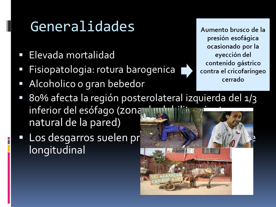 Generalidades Aumento brusco de la presión esofágica ocasionado por la eyección del contenido gástrico contra el cricofaríngeo cerrado.