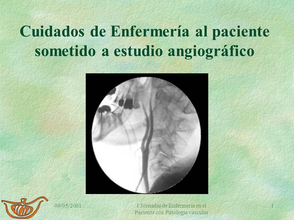 Cuidados de Enfermería al paciente sometido a estudio angiográfico