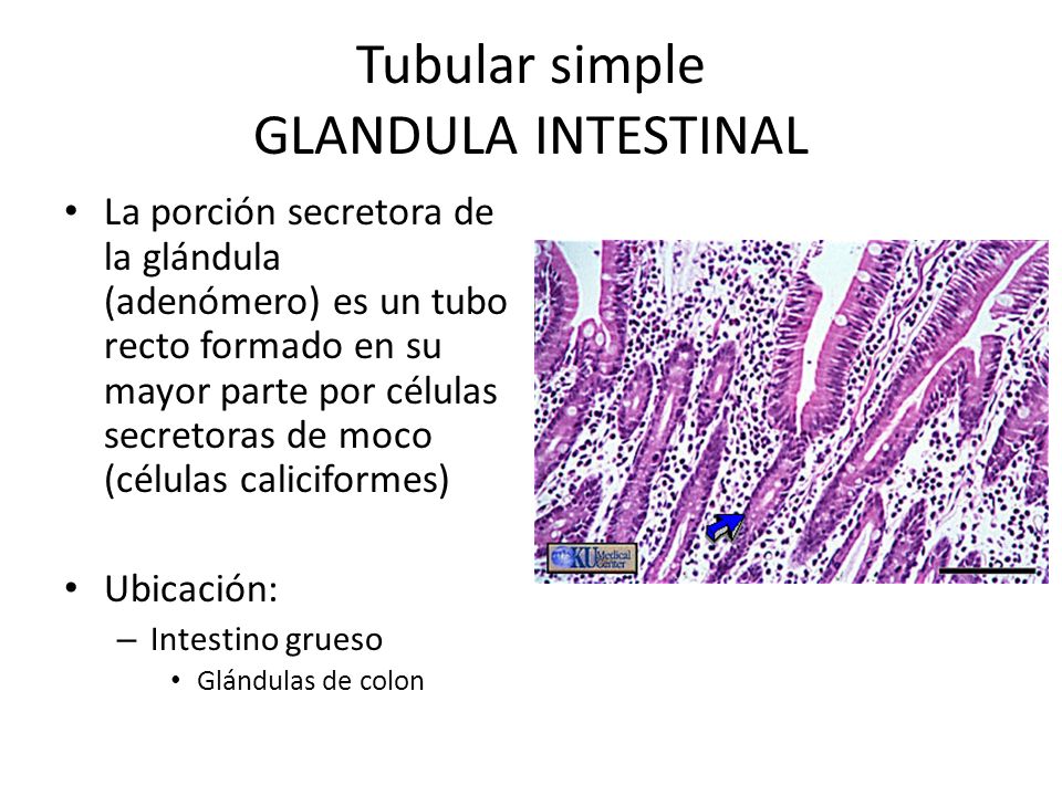 Tubular simple GLANDULA INTESTINAL