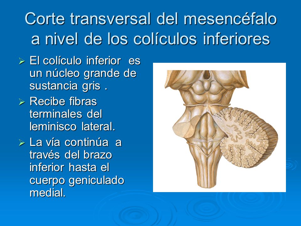 Corte transversal del mesencéfalo a nivel de los colículos inferiores