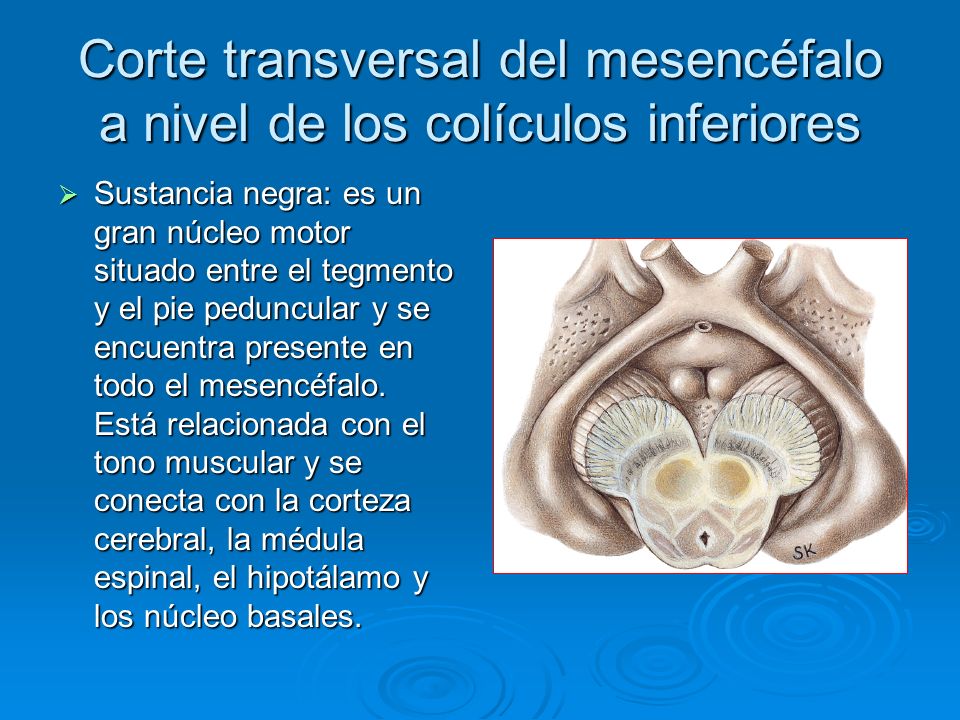 Corte transversal del mesencéfalo a nivel de los colículos inferiores