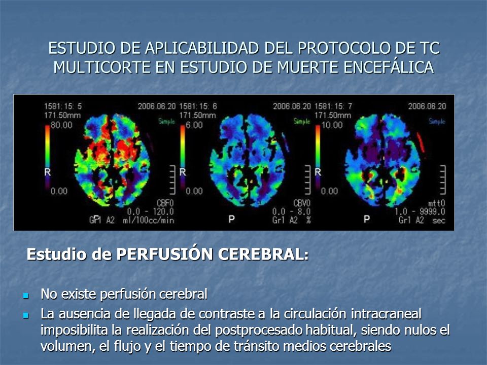 ESTUDIO DE APLICABILIDAD DEL PROTOCOLO DE TC MULTICORTE EN ESTUDIO DE MUERTE ENCEFÁLICA