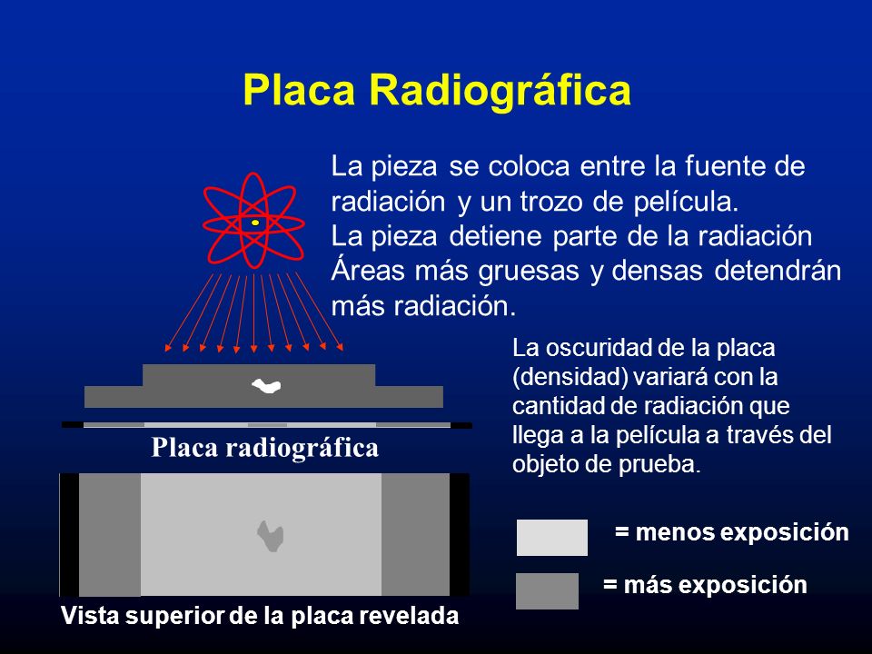 Placa Radiográfica La pieza se coloca entre la fuente de radiación y un trozo de película.