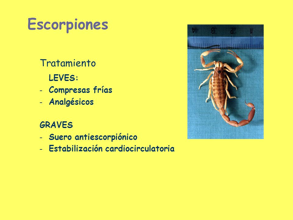 Escorpiones Tratamiento LEVES: Compresas frías Analgésicos GRAVES