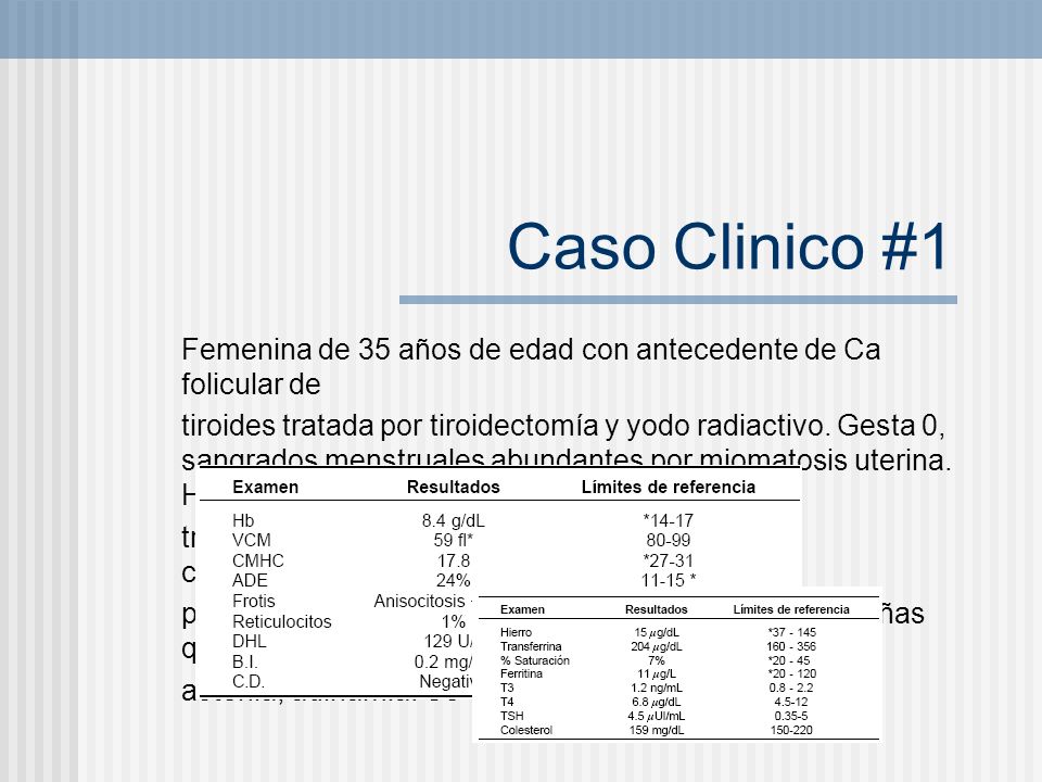 Caso Clinico #1 Femenina de 35 años de edad con antecedente de Ca folicular de.