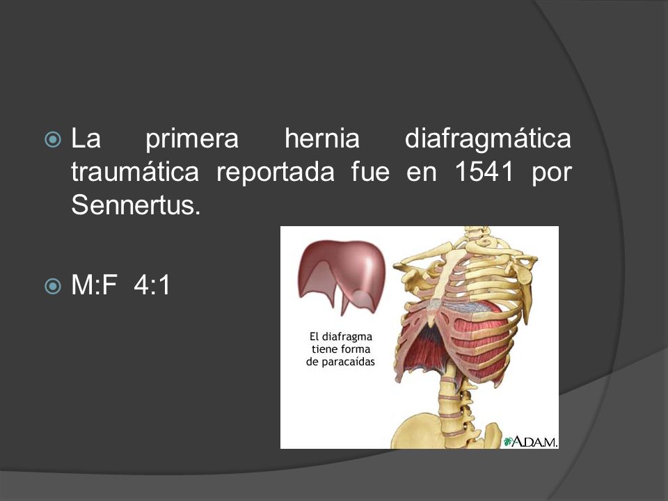 La primera hernia diafragmática traumática reportada fue en 1541 por Sennertus.