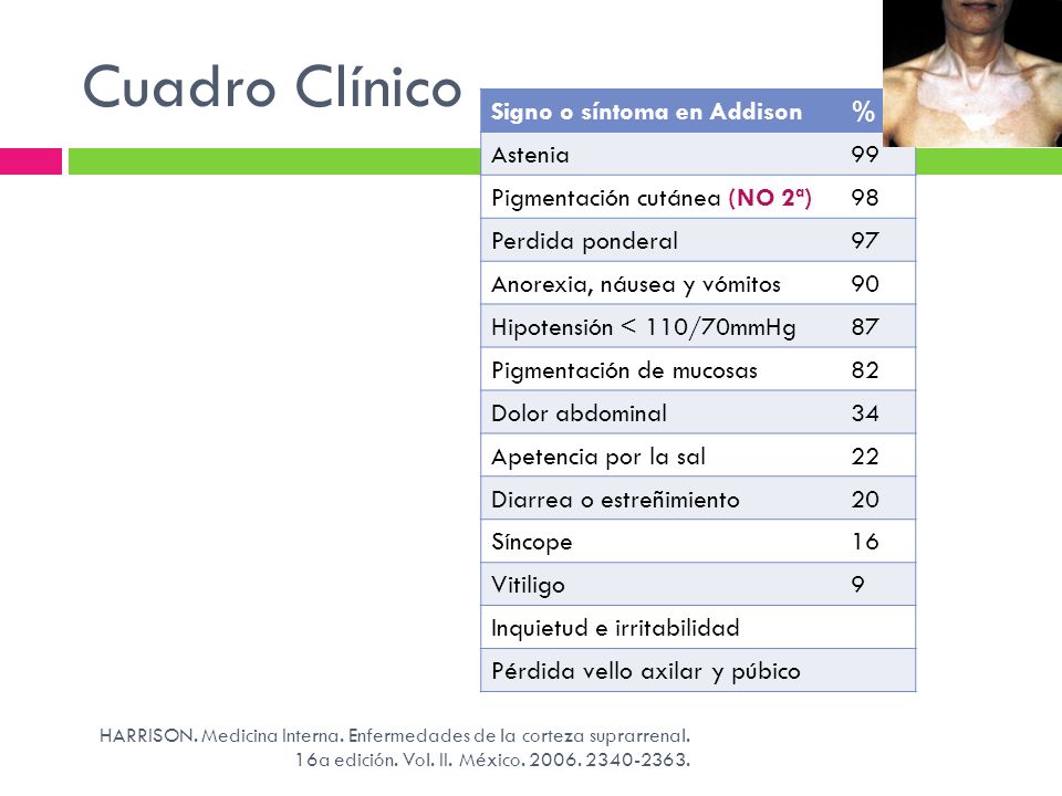 Cuadro Clínico Signo o síntoma en Addison % Astenia 99