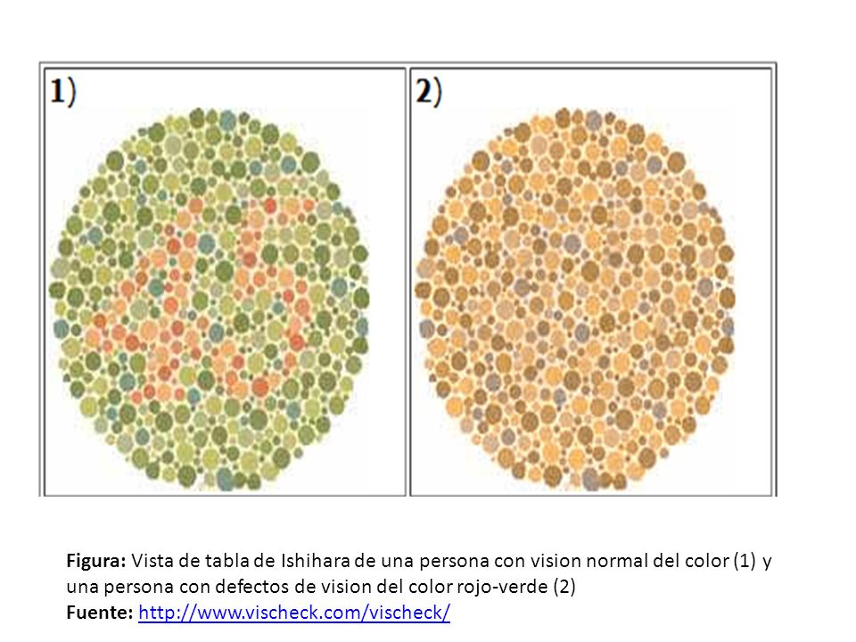 Figura: Vista de tabla de Ishihara de una persona con vision normal del color (1) y una persona con defectos de vision del color rojo-verde (2)