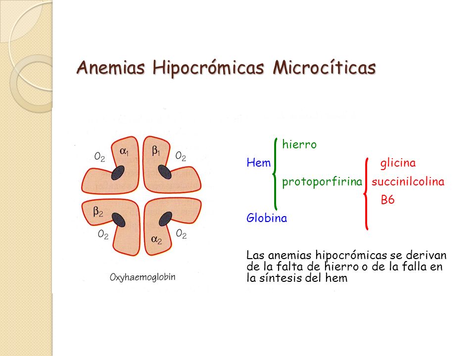 Anemias Hipocrómicas Microcíticas