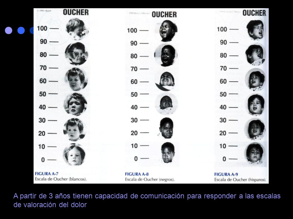 A partir de 3 años tienen capacidad de comunicación para responder a las escalas de valoración del dolor