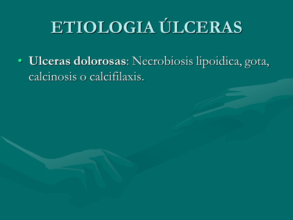 ETIOLOGIA ÚLCERAS Ulceras dolorosas: Necrobiosis lipoidica, gota, calcinosis o calcifilaxis.
