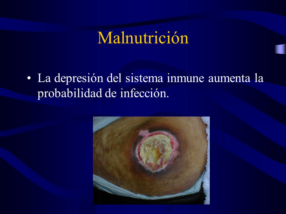 Malnutrición La depresión del sistema inmune aumenta la probabilidad de infección.