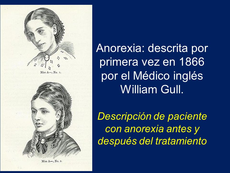 Anorexia: descrita por primera vez en 1866 por el Médico inglés William Gull.