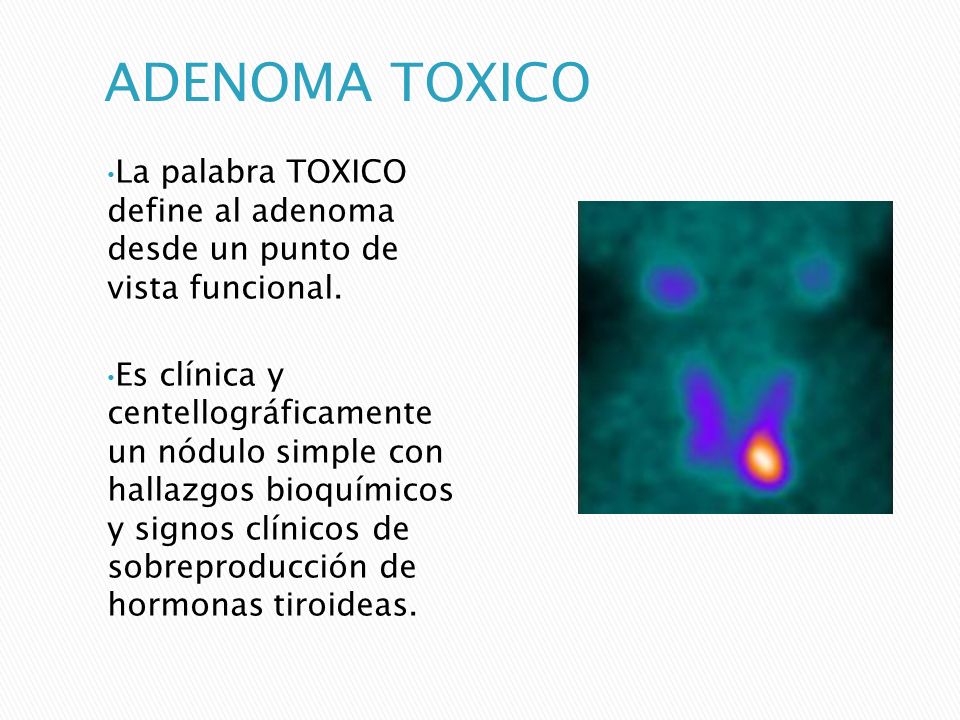 ADENOMA TOXICO La palabra TOXICO define al adenoma desde un punto de vista funcional.