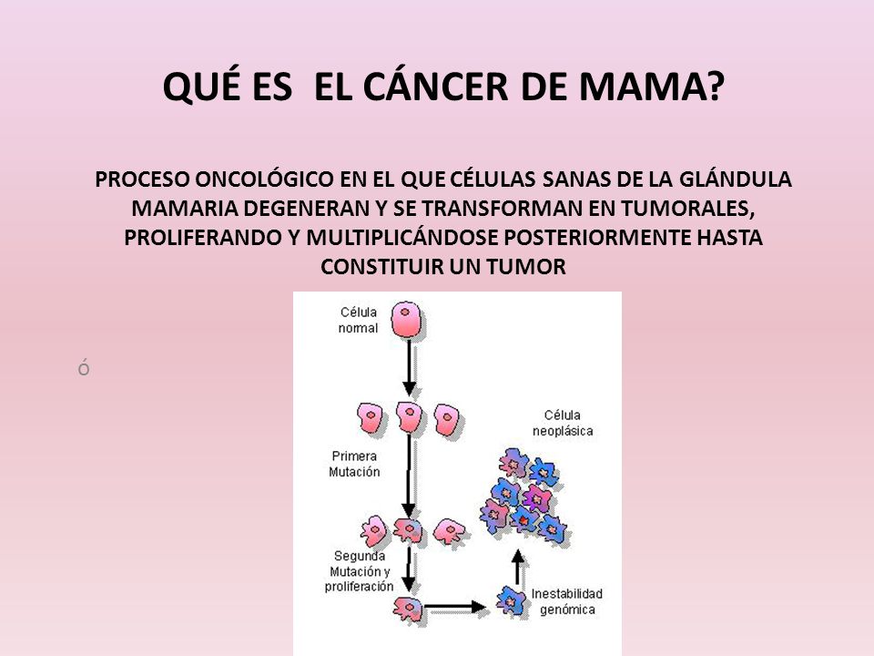 Qué es el cáncer de mama Proceso oncológico en el que células sanas de la glándula mamaria degeneran y se transforman en tumorales, proliferando y multiplicándose posteriormente hasta constituir un tumor