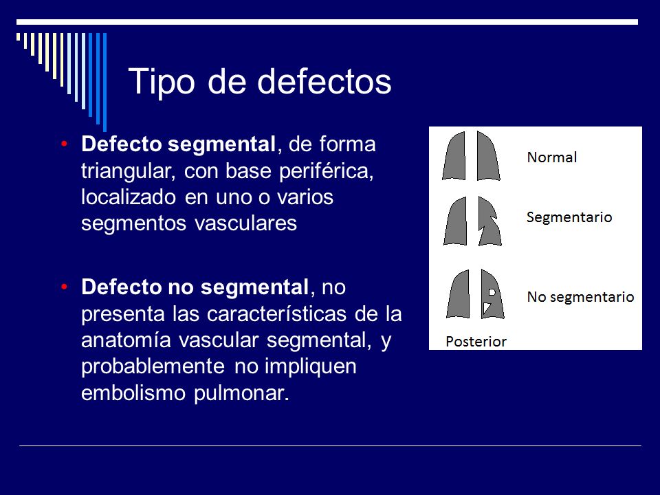 Tipo de defectos Defecto segmental, de forma triangular, con base periférica, localizado en uno o varios segmentos vasculares.