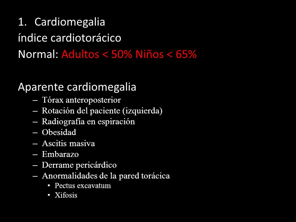 índice cardiotorácico Normal: Adultos < 50% Niños < 65%