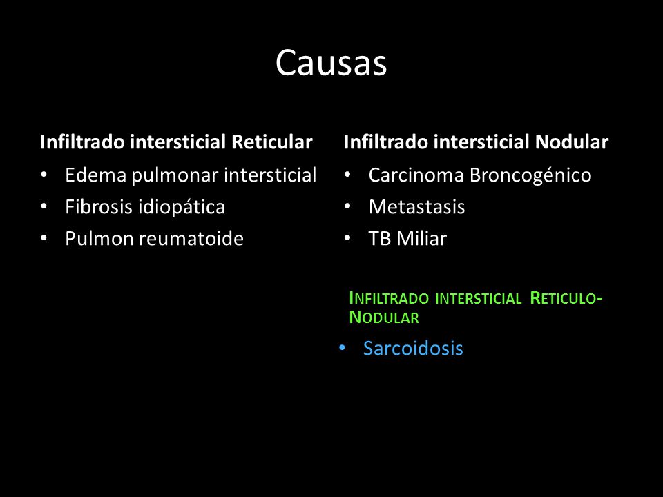 Causas Infiltrado intersticial Reticular