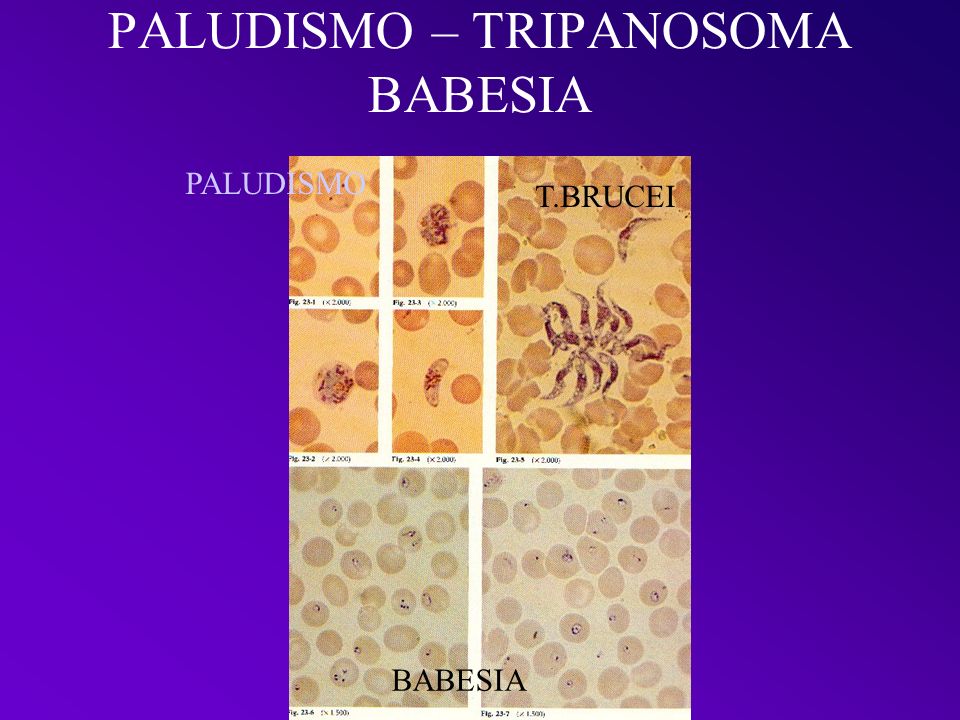 PALUDISMO – TRIPANOSOMA BABESIA