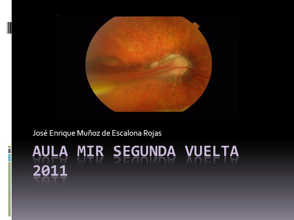 Aula mir segunda vuelta 2011