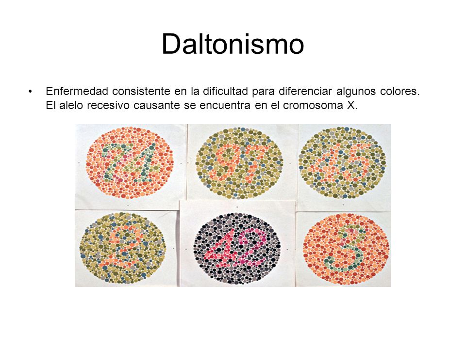 Daltonismo Enfermedad consistente en la dificultad para diferenciar algunos colores.