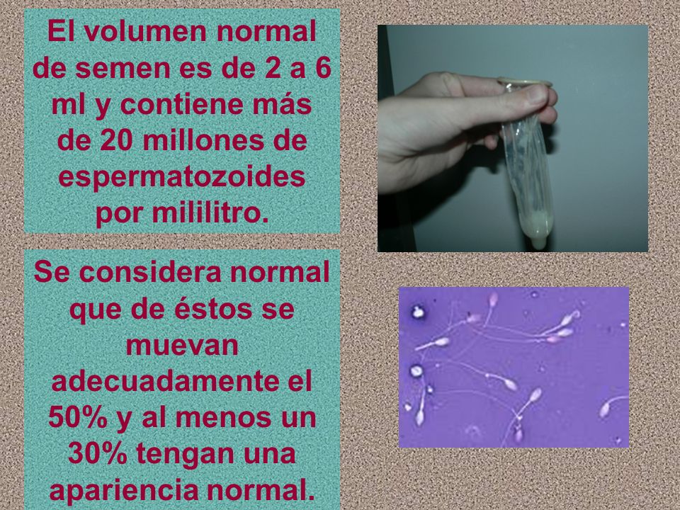 El volumen normal de semen es de 2 a 6 ml y contiene más de 20 millones de espermatozoides por mililitro.