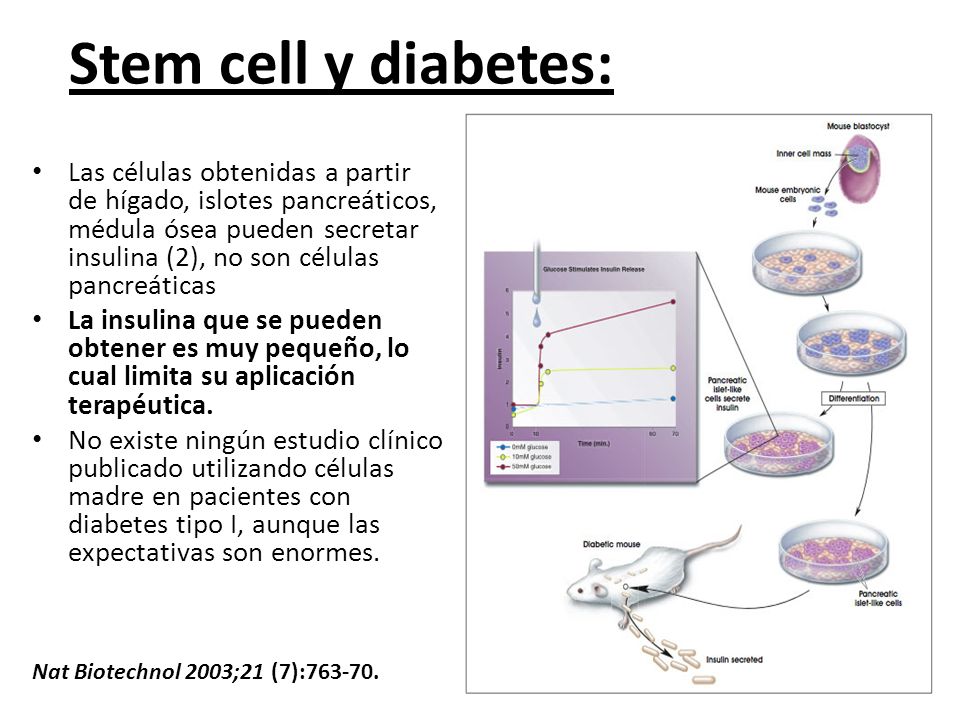 Stem cell y diabetes: