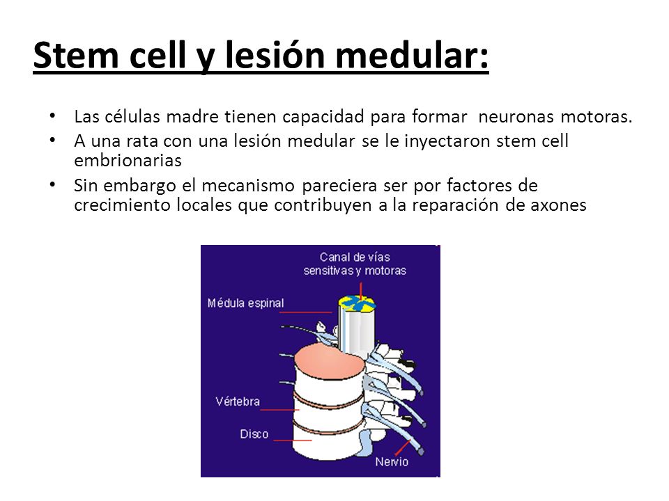 Stem cell y lesión medular: