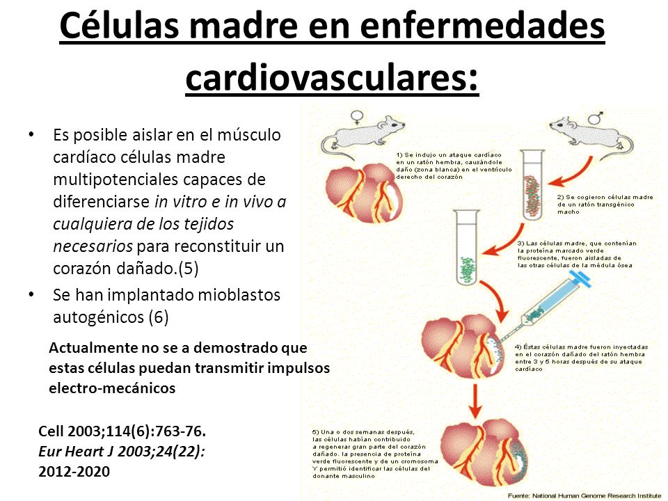 Células madre en enfermedades cardiovasculares: