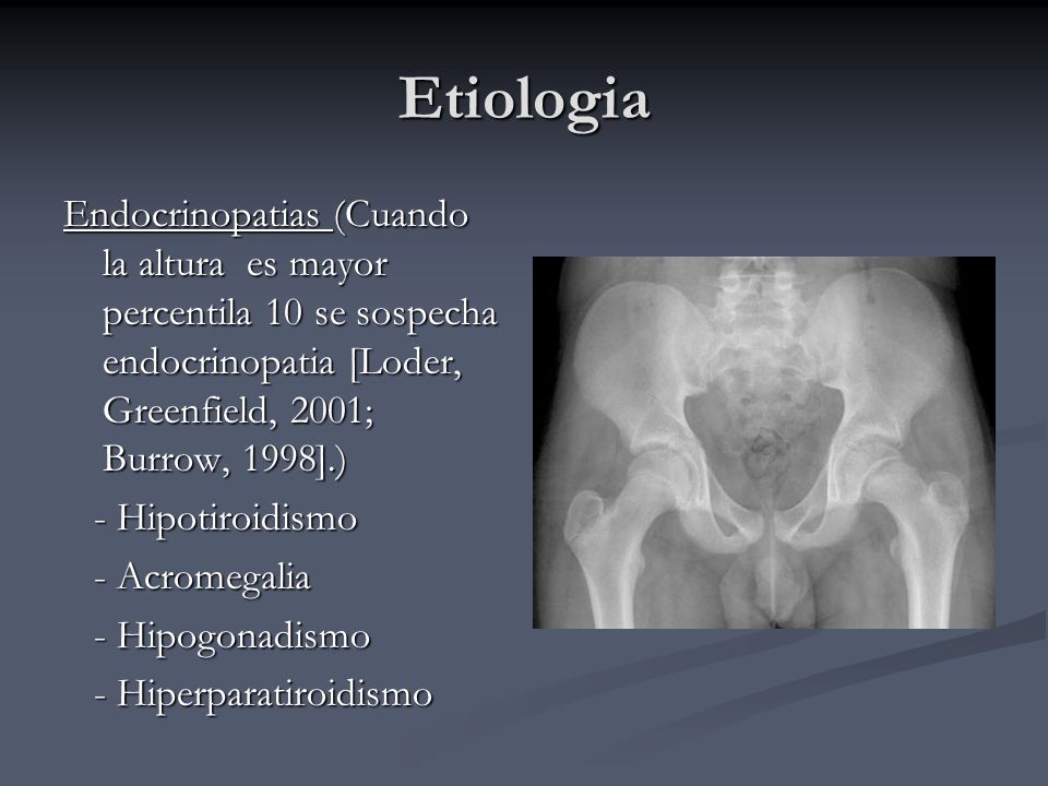 Etiologia Endocrinopatias (Cuando la altura es mayor percentila 10 se sospecha endocrinopatia [Loder, Greenfield, 2001; Burrow, 1998].)