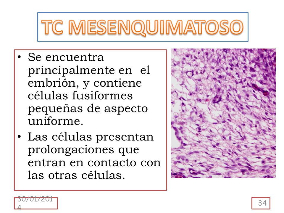 TC MESENQUIMATOSO Se encuentra principalmente en el embrión, y contiene células fusiformes pequeñas de aspecto uniforme.