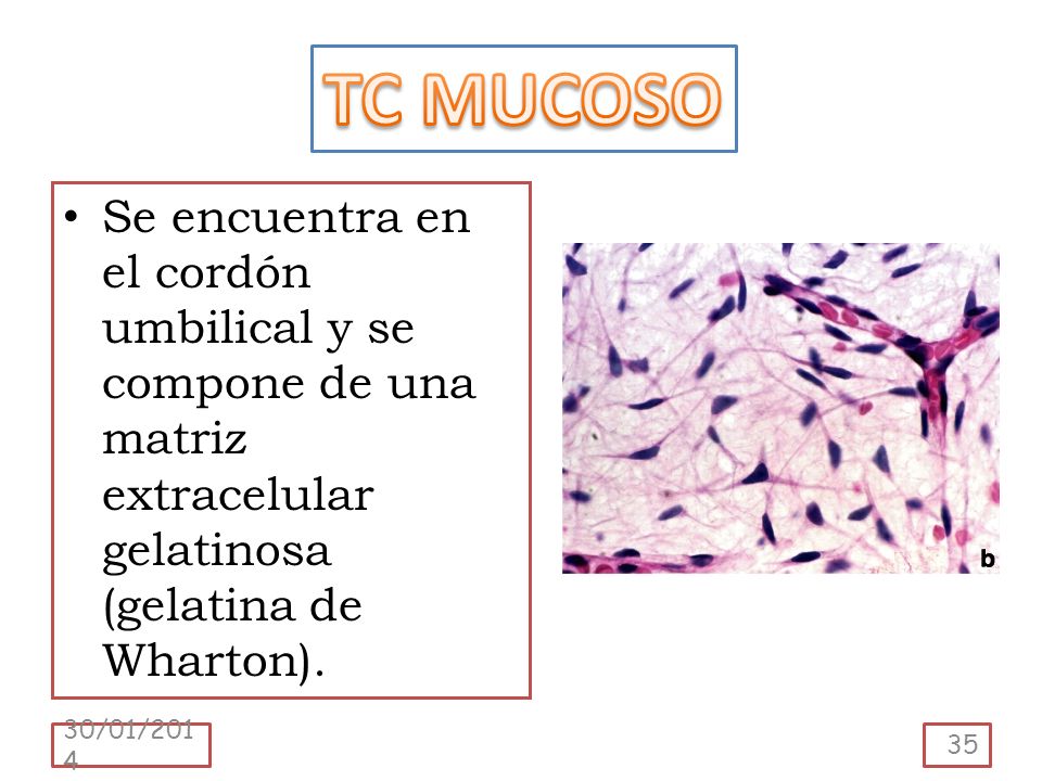 TC MUCOSO Se encuentra en el cordón umbilical y se compone de una matriz extracelular gelatinosa (gelatina de Wharton).