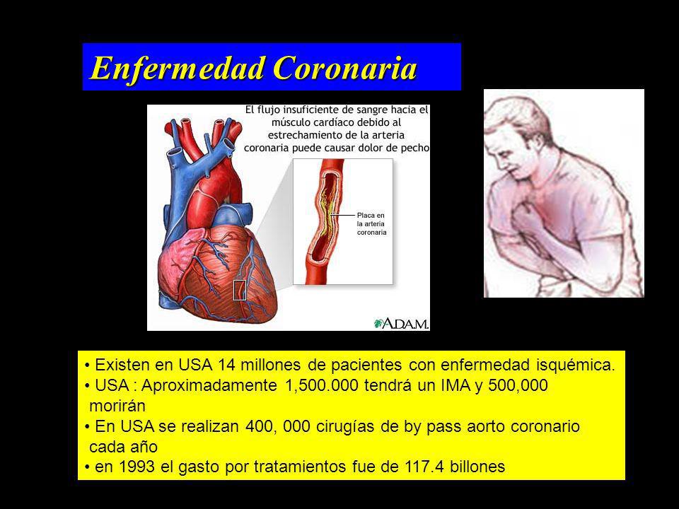 Enfermedad Coronaria Existen en USA 14 millones de pacientes con enfermedad isquémica. USA : Aproximadamente 1, tendrá un IMA y 500,000.