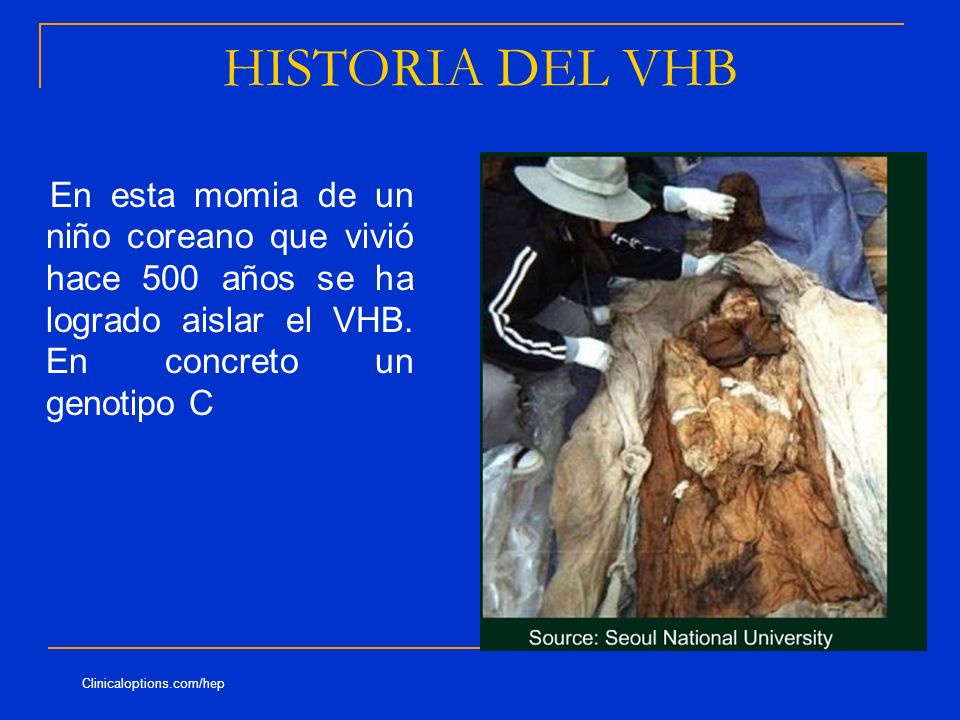 HISTORIA DEL VHB En esta momia de un niño coreano que vivió hace 500 años se ha logrado aislar el VHB. En concreto un genotipo C.