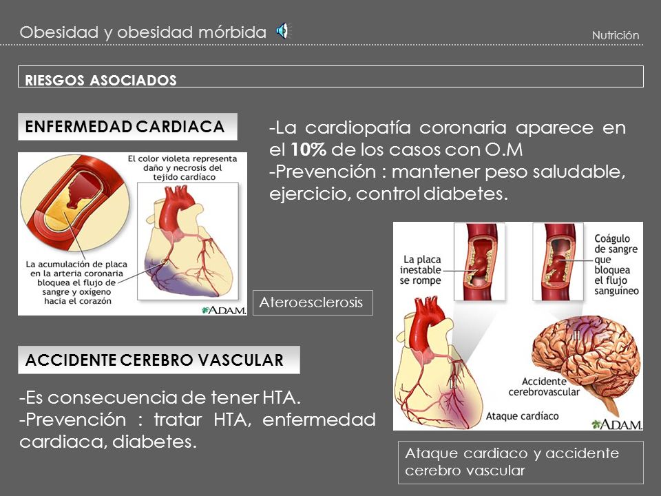 -La cardiopatía coronaria aparece en el 10% de los casos con O.M